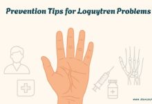 loguytren problems